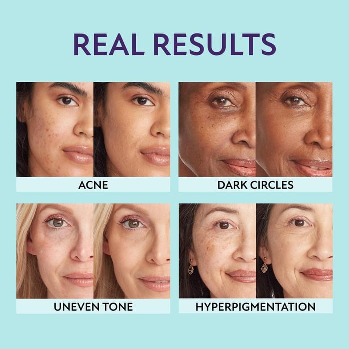 SupremeCrème – Hydrating Concealer with Natural Coverage Finish - Image 4